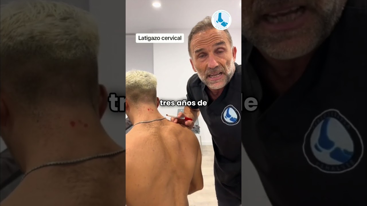 latigazo cervical consecuencias a largo plazo