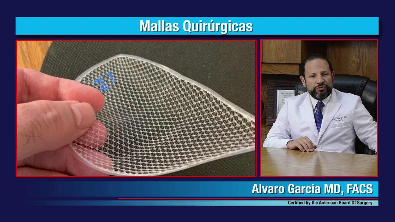 líquido acumulado operación hernia con malla