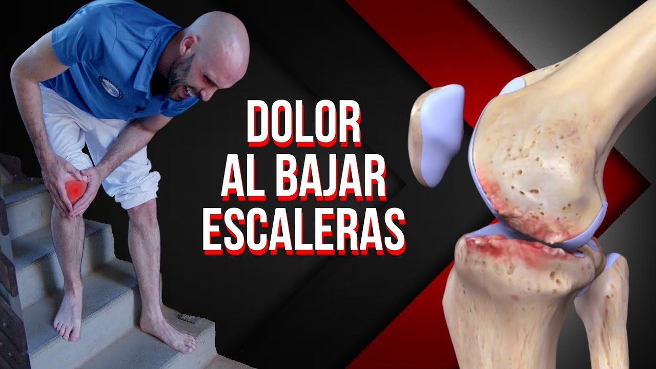 me duele la rodilla al bajar las escaleras
