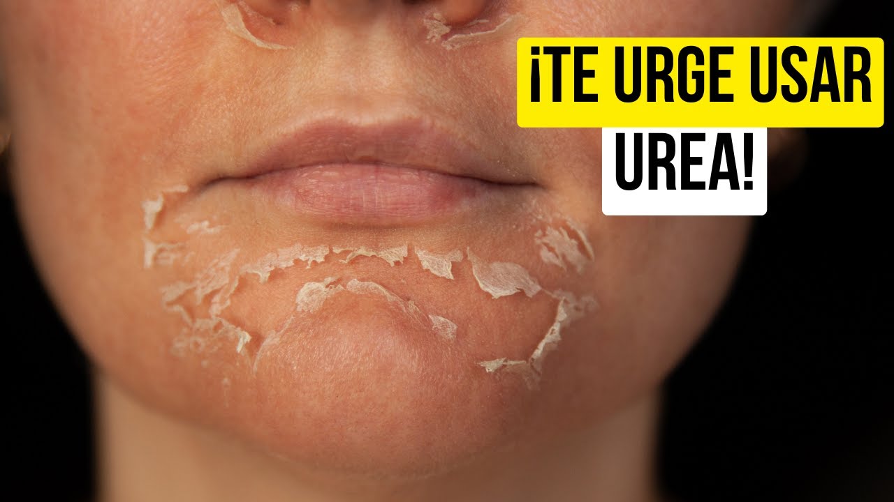 mejor crema con urea para pies