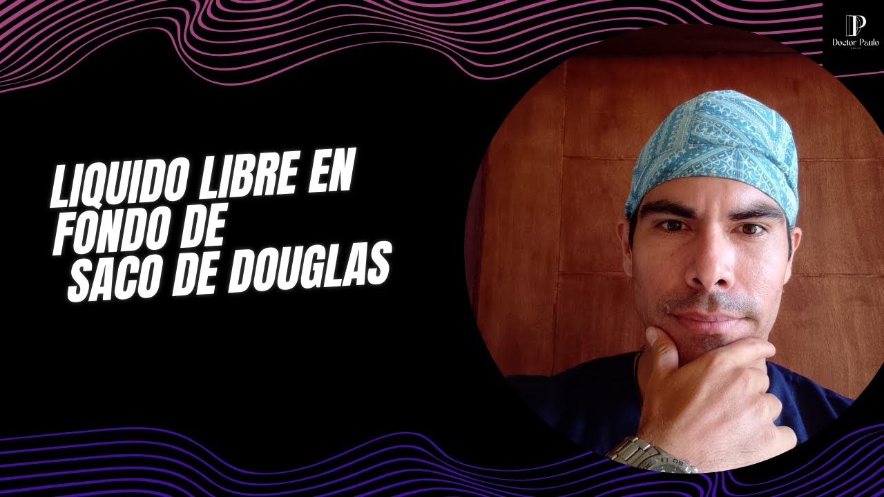 porque tengo líquido en el saco de douglas