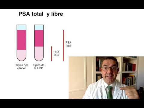 psa alto y resonancia magnética negativa