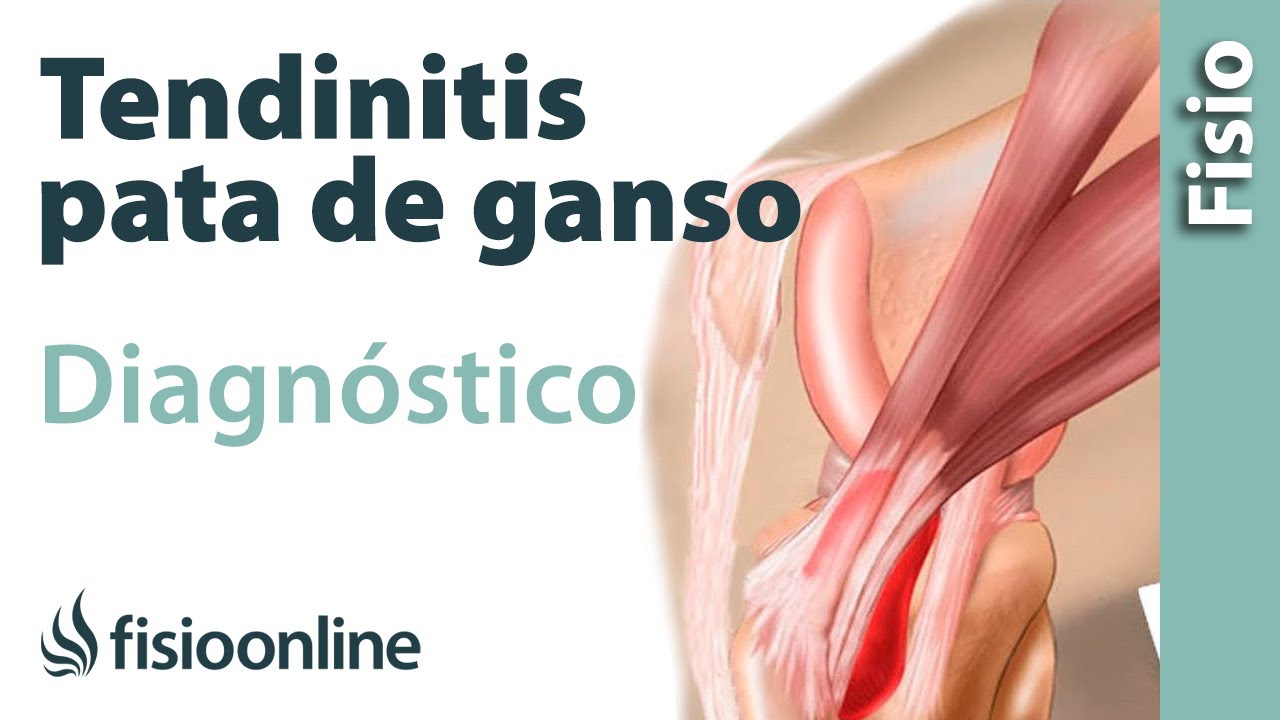 que es la pata de ganso en la rodilla