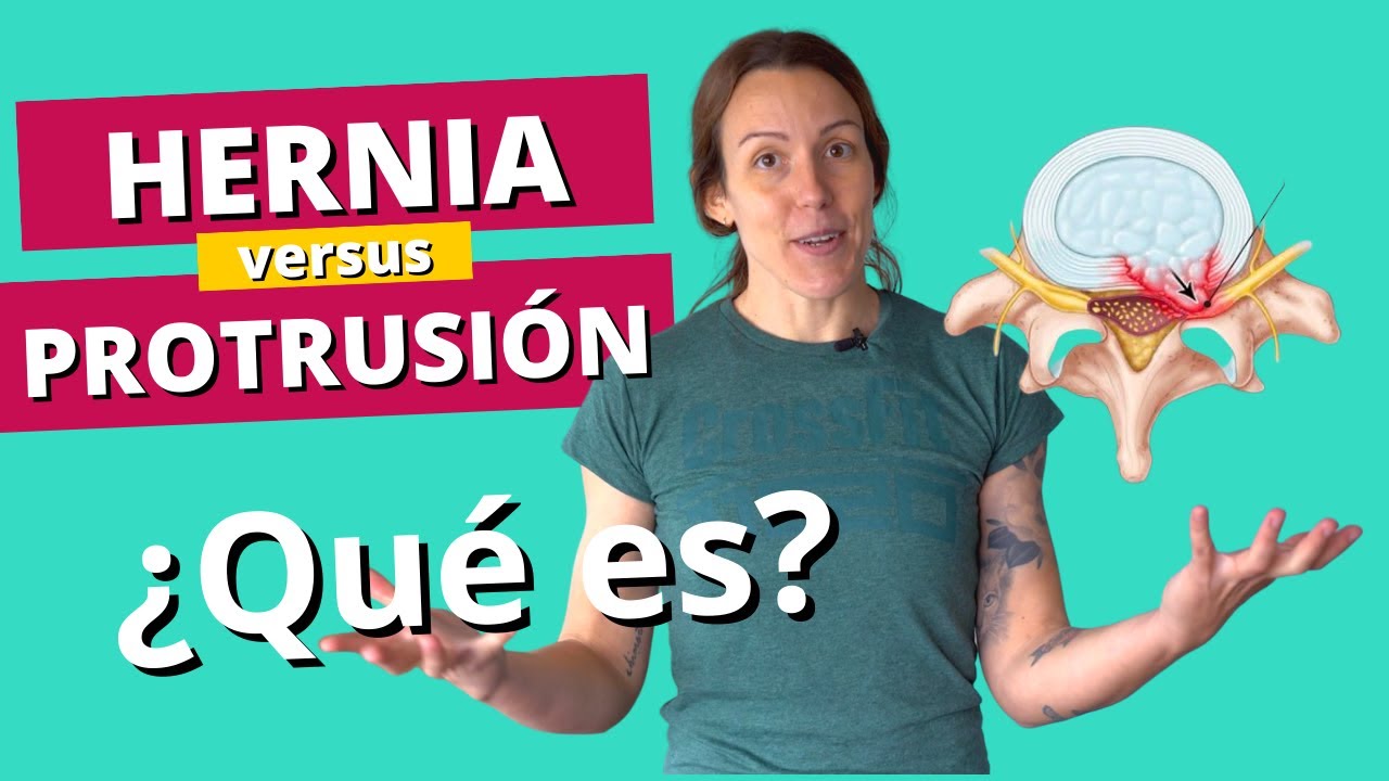 que es peor hernia o protrusión