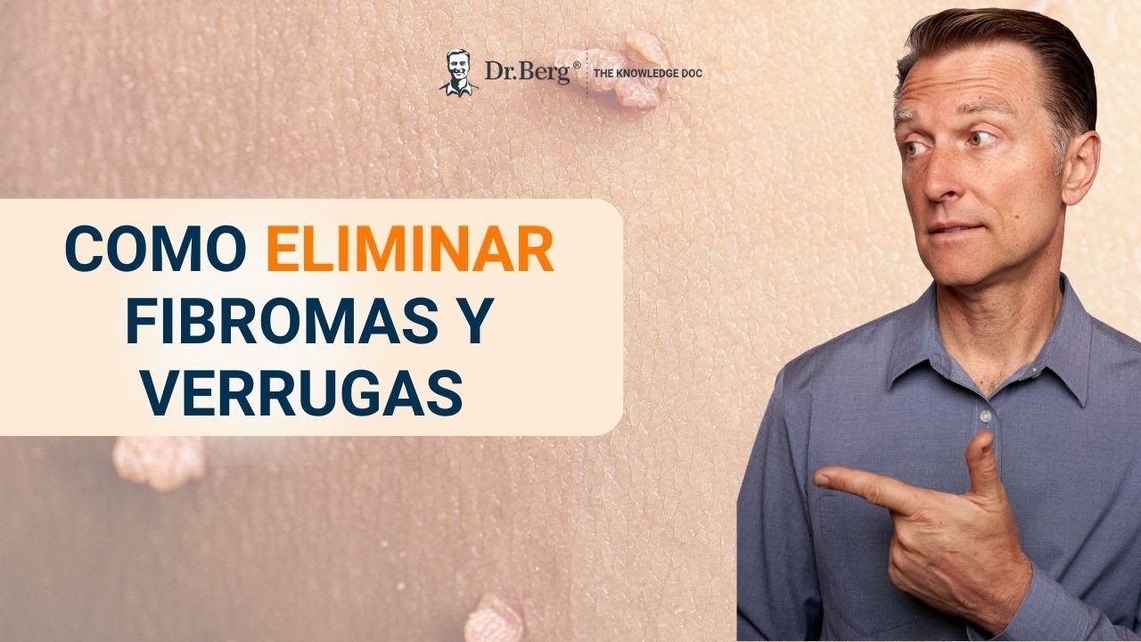 que es un fibroma en la piel