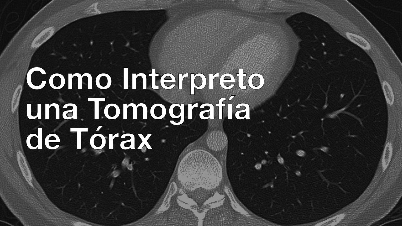 que órganos se ven en un tac de tórax