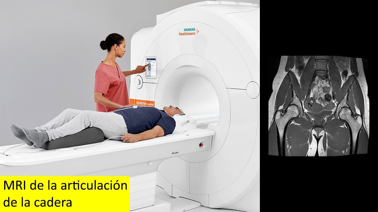 que se ve en una resonancia magnética de cadera