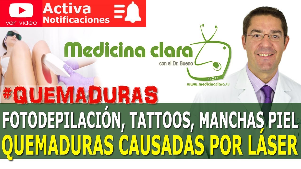 quemadura por laser en la cara