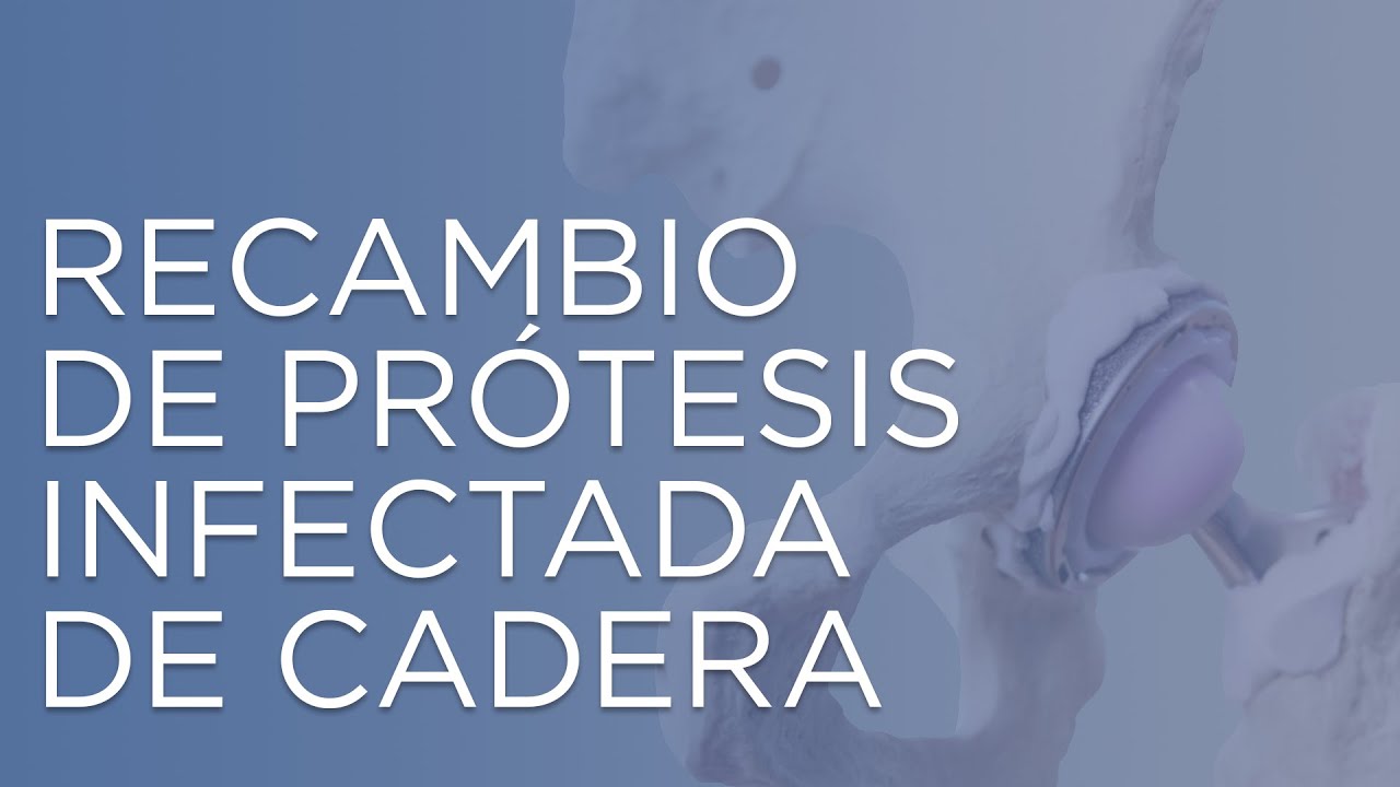 recambio de prótesis de cadera por infección
