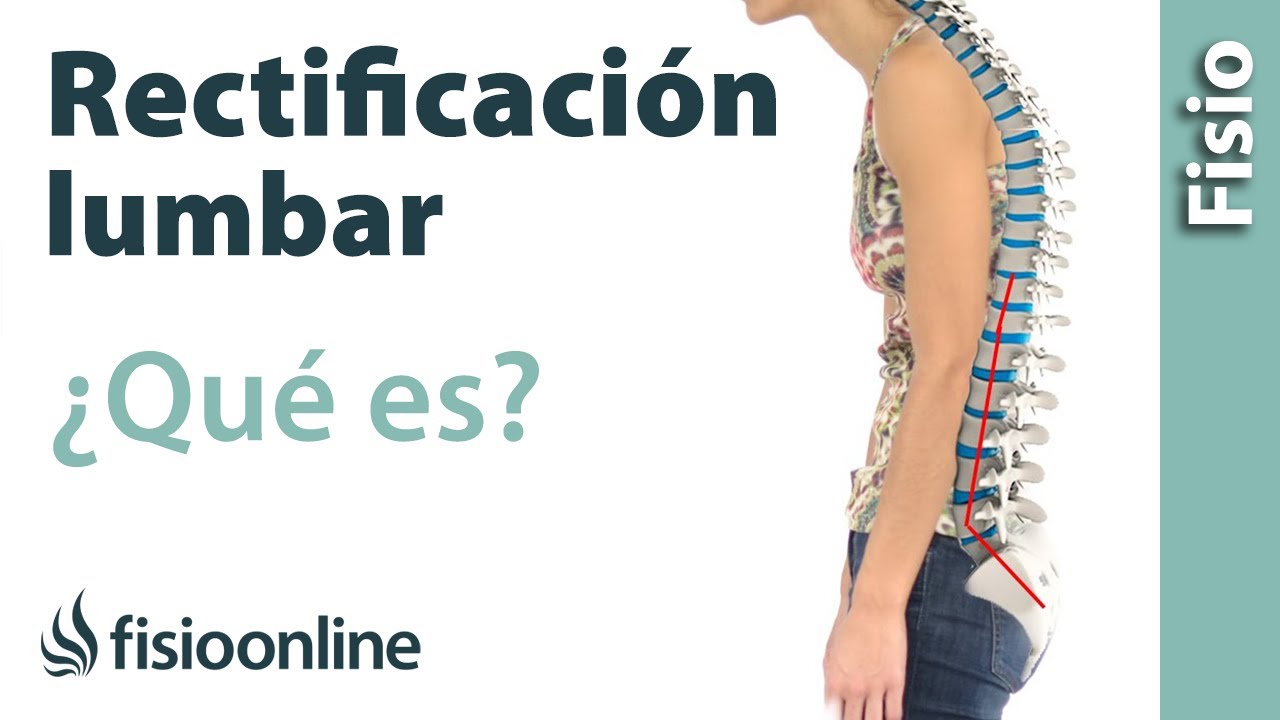 rectificación de la lordosis fisiológica lumbar