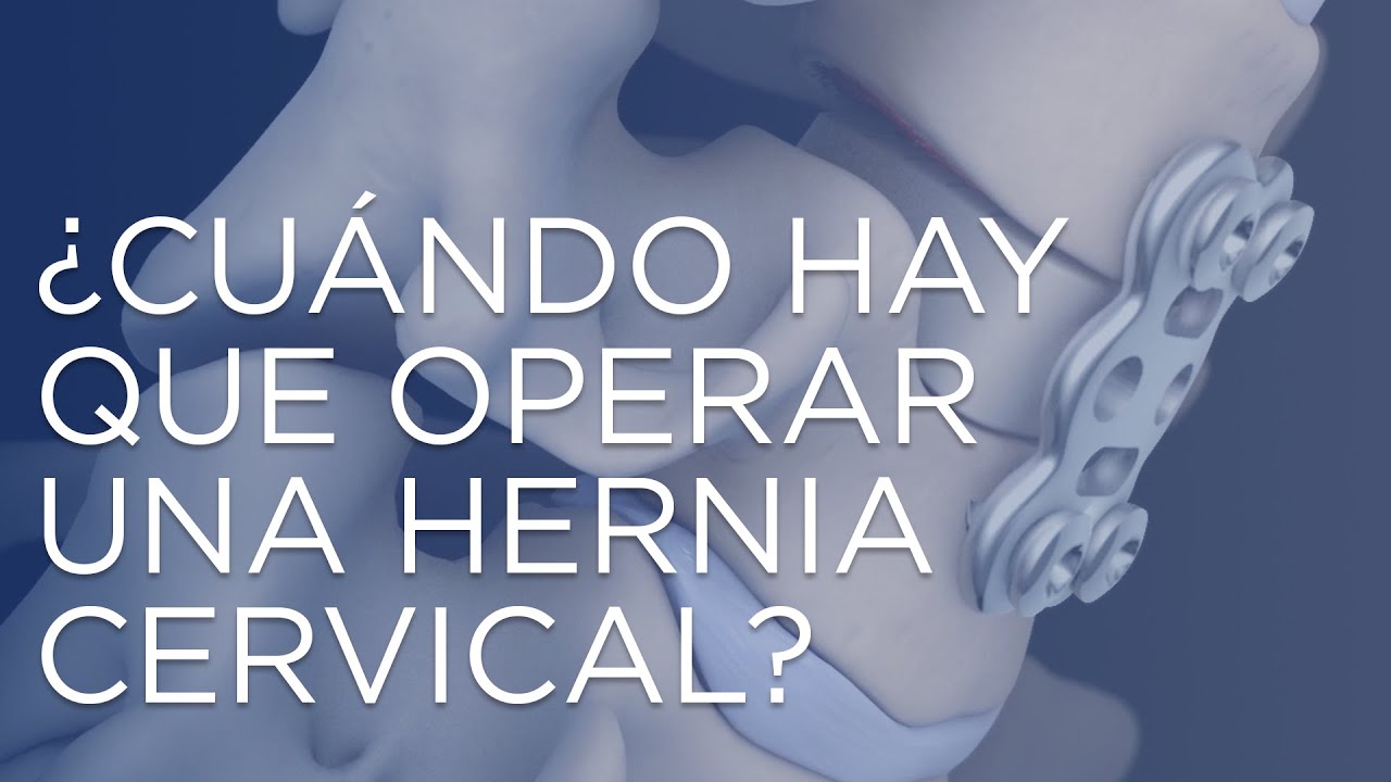 recuperacion operacion hernia cervical c5 c6