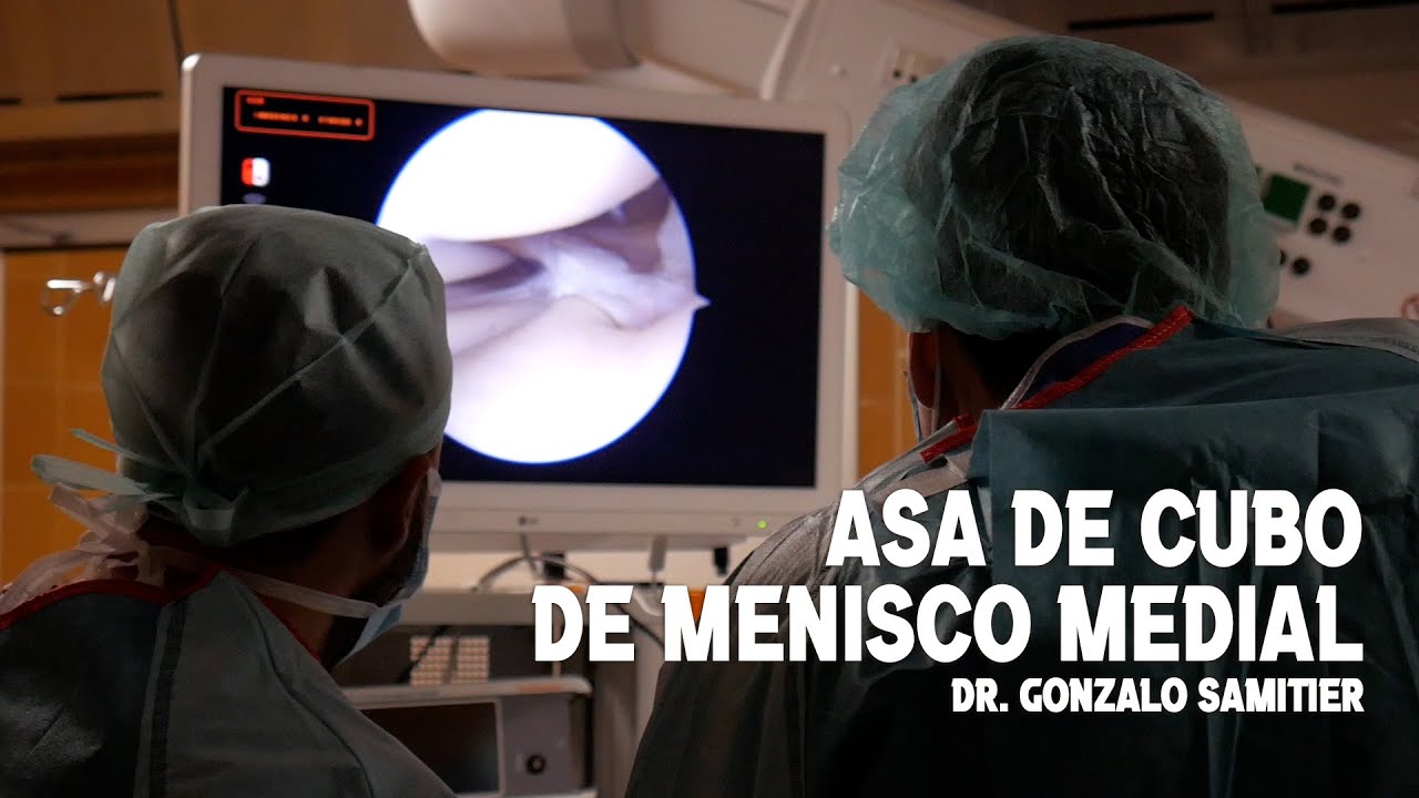 recuperación rotura menisco asa de cubo