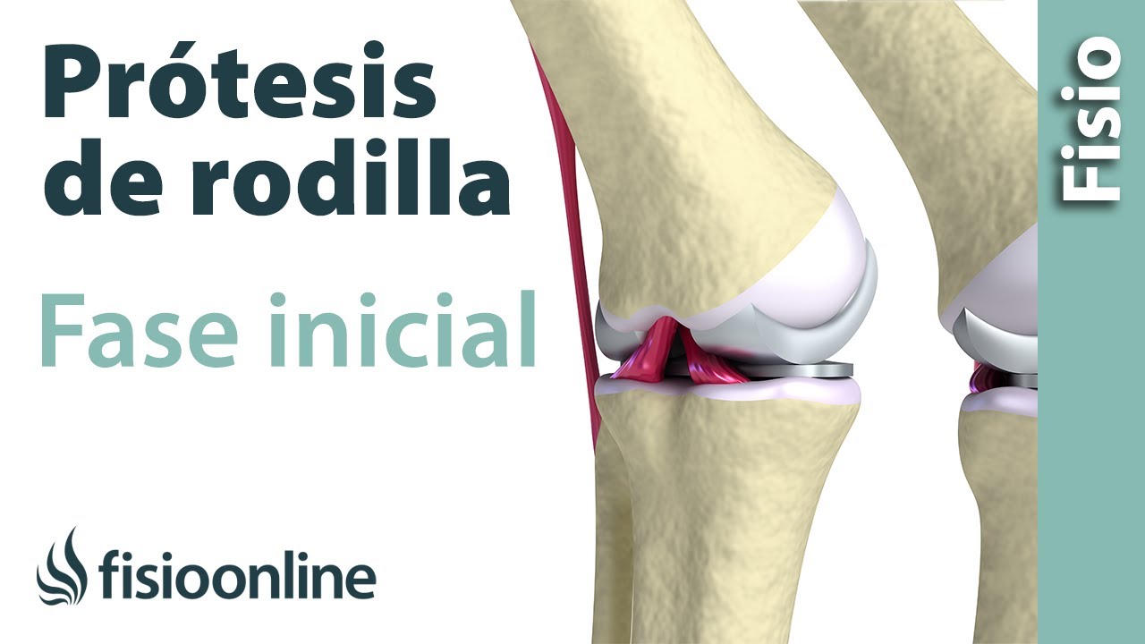 rehabilitacion de rodilla operada con protesis