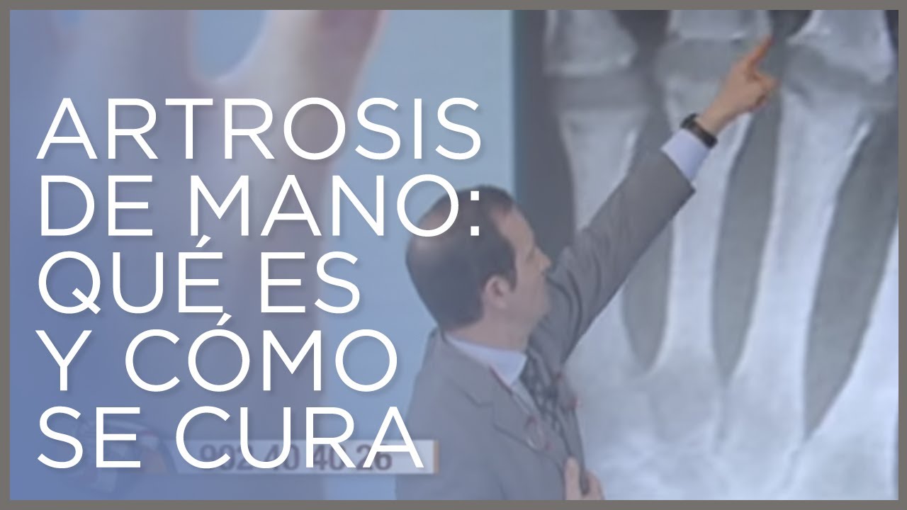 remedios para la artrosis en manos