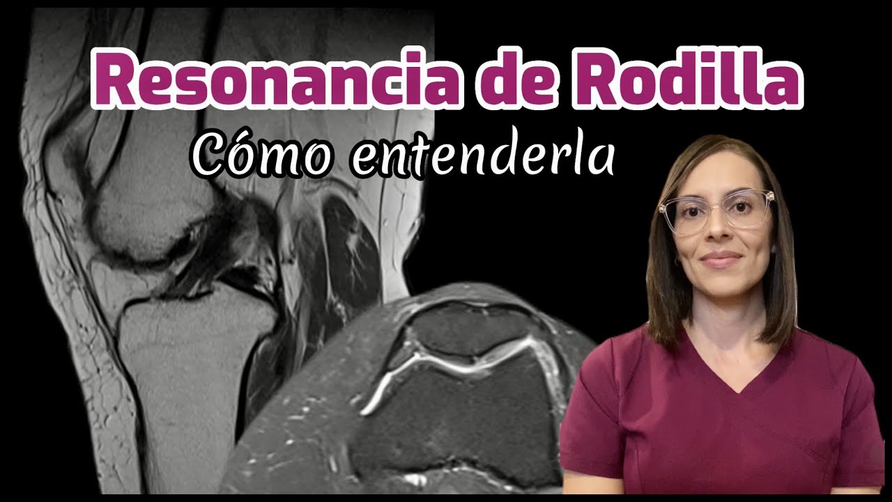 rotura de menisco interno resonancia magnetica