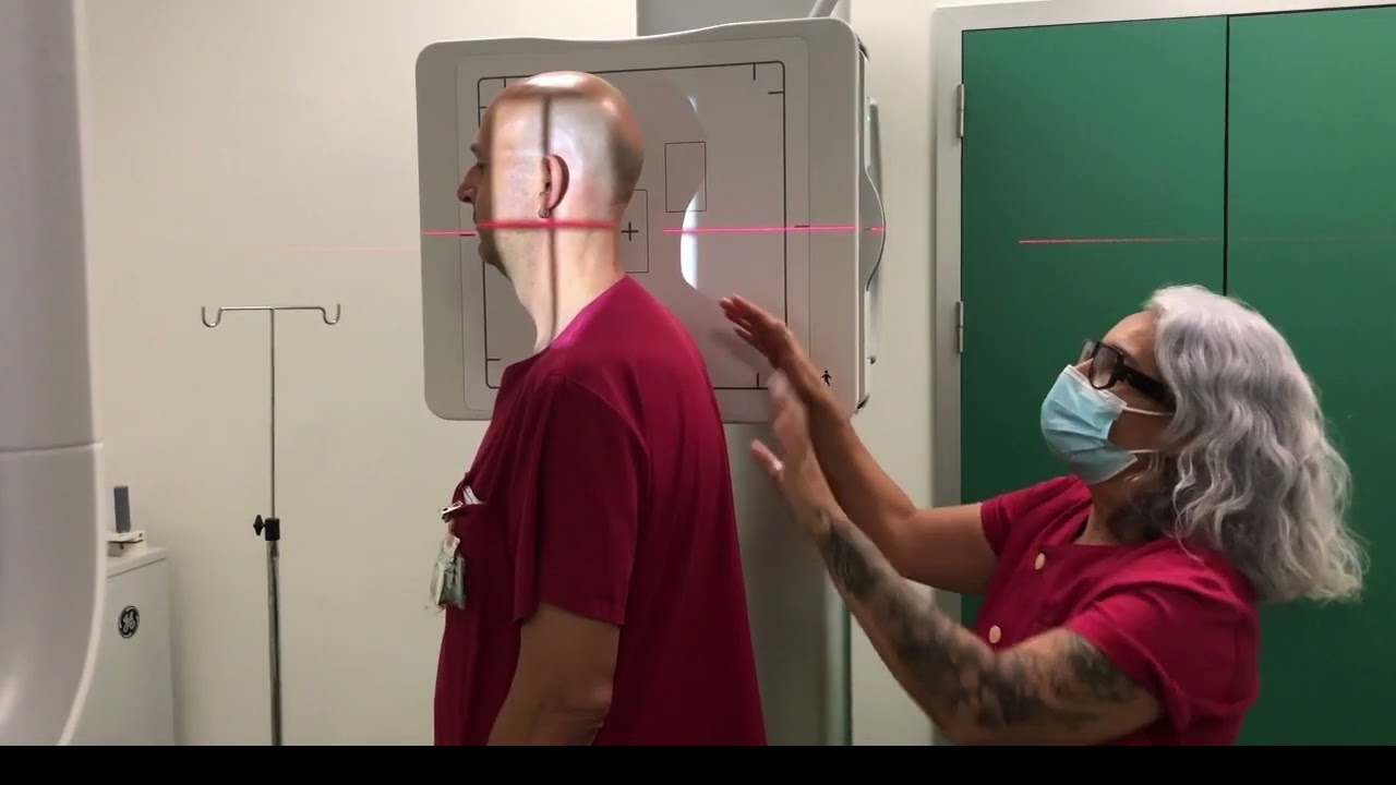 rx columna cervical ap y lat