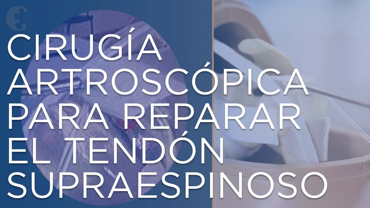 se puede trabajar con el supraespinoso roto