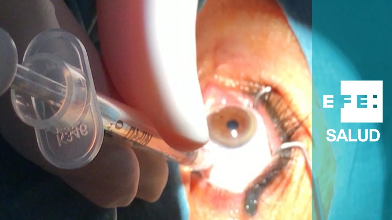 son efectivas las inyecciones en el ojo para el edema