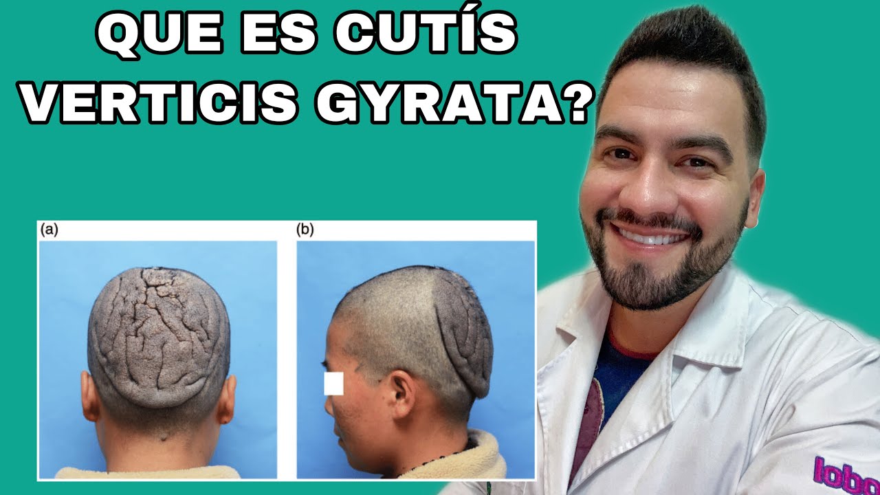 surcos en la cabeza por estrés