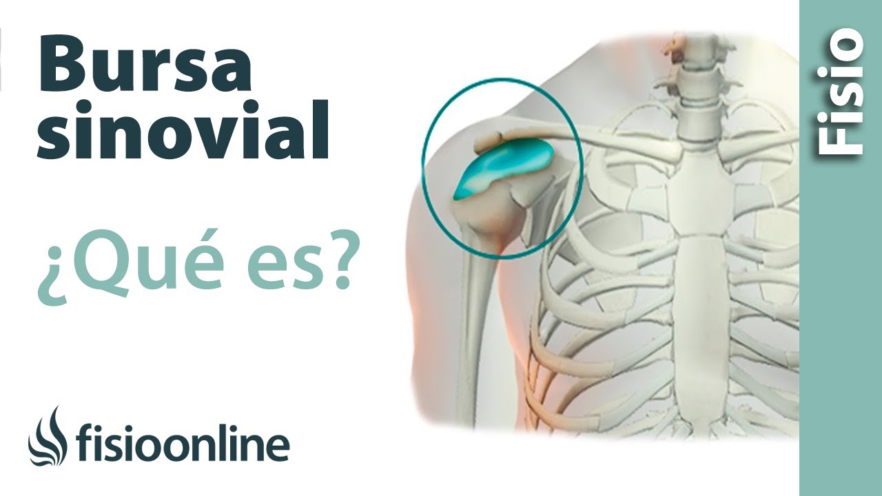 tiempo de baja laboral por bursitis