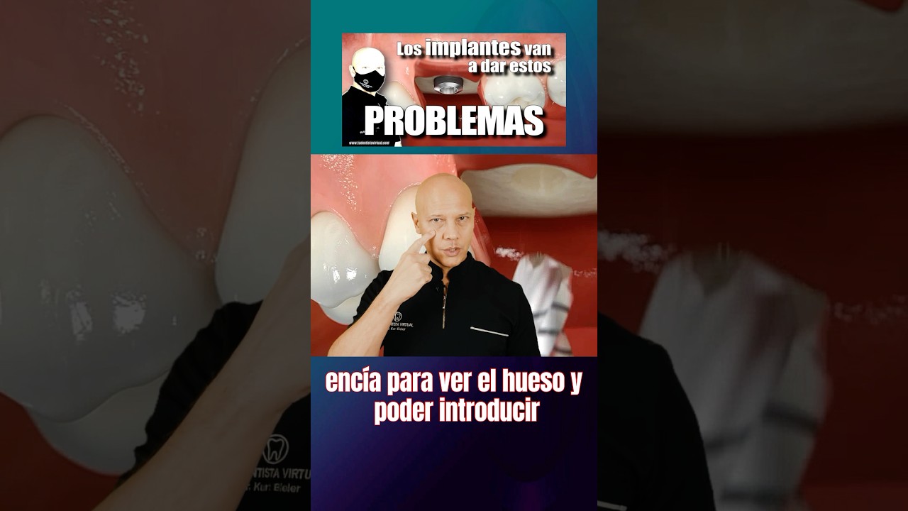 tomar antibiótico para poner implante dental