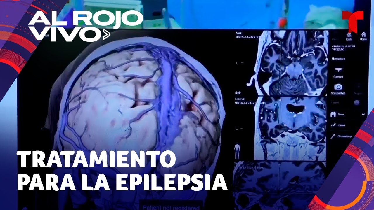 últimos avances en la cura de la epilepsia