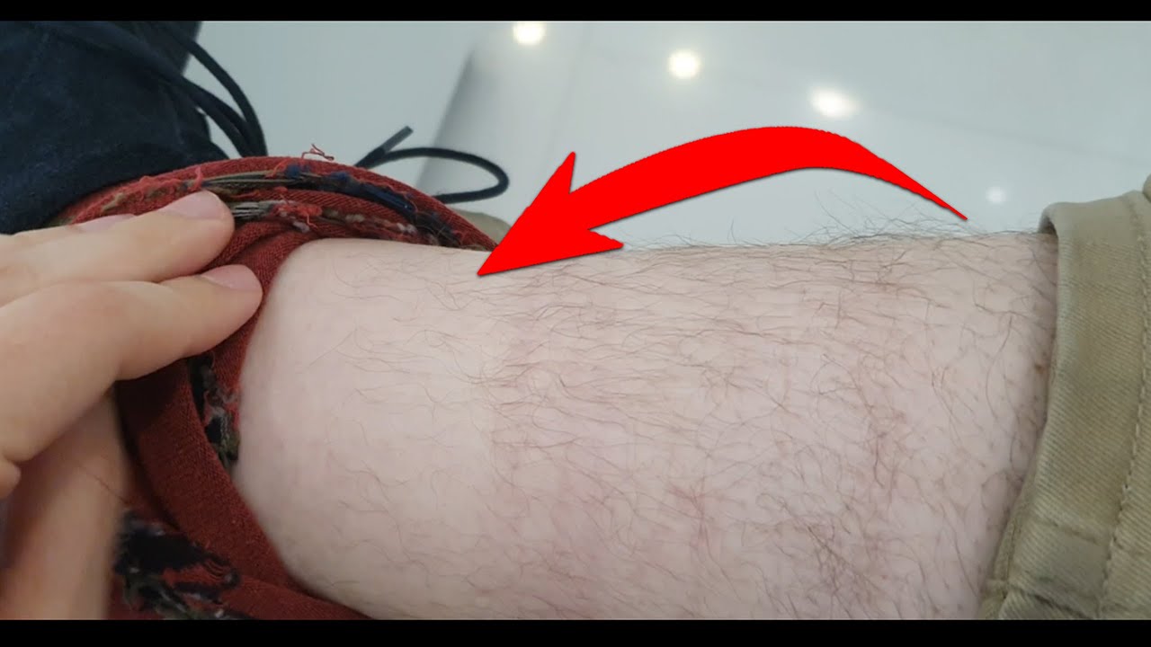 a que edad se cae el pelo de las piernas