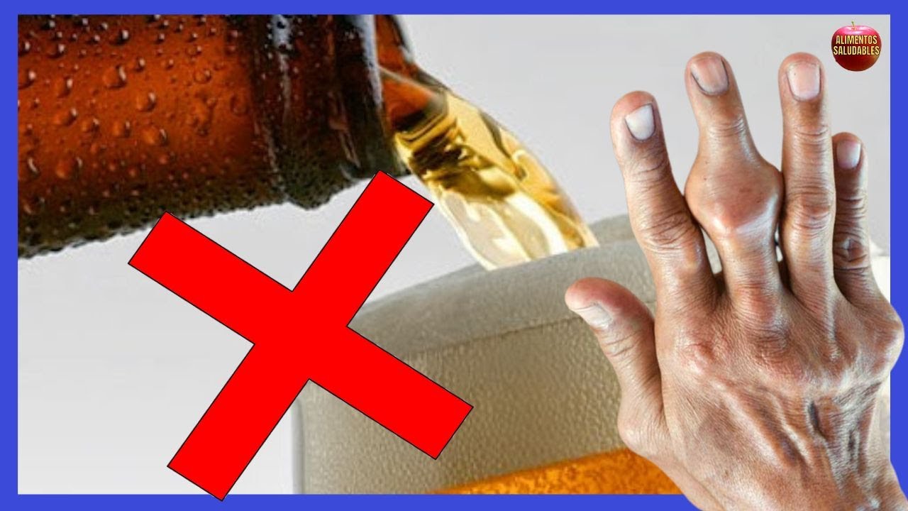bebidas alcohólicas que no afectan el ácido úrico