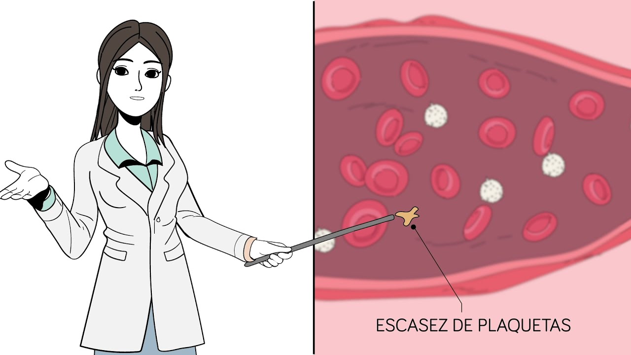 beta 2 glicoproteína igg positivo que significa
