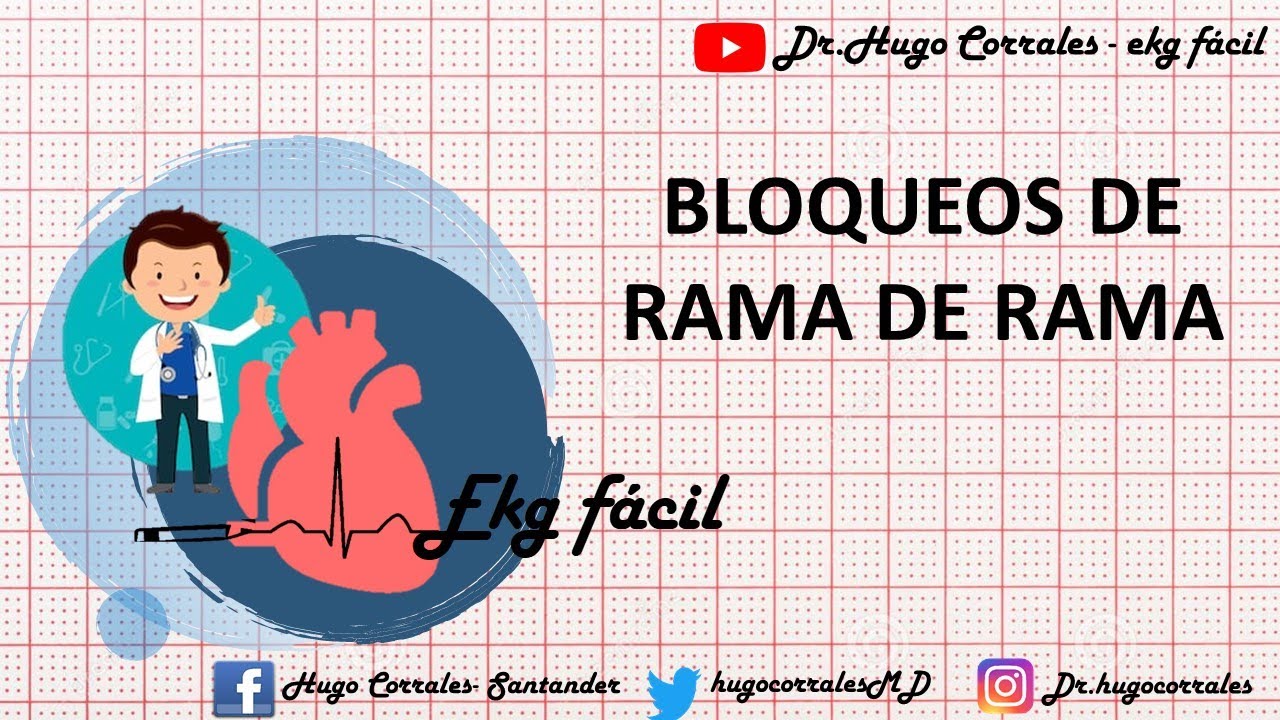 bloqueo rama derecha e izquierda ecg