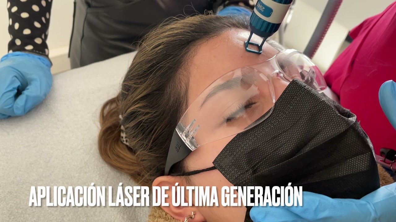borrar cicatrices con láser antes y después