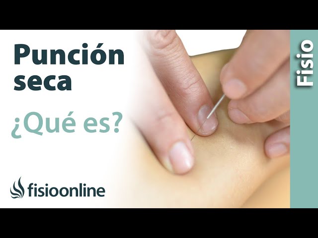 calor o frío después de punción seca