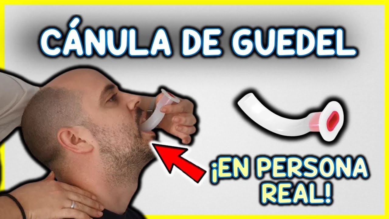 cánula de guedel tamaños por edad