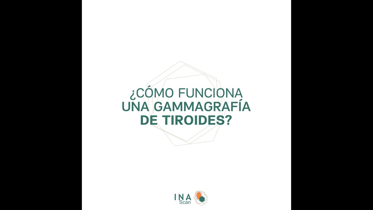 como se hace una gammagrafia tiroidea