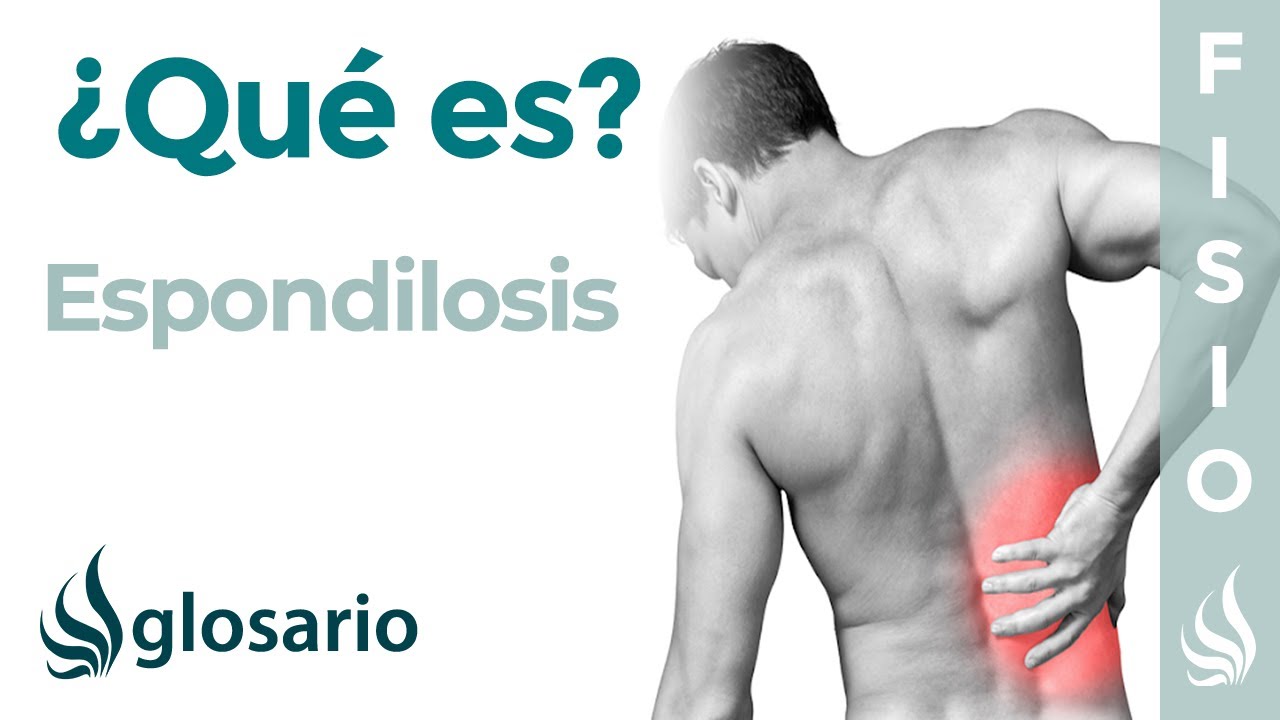 con espondilosis lumbosacra se puede trabajar