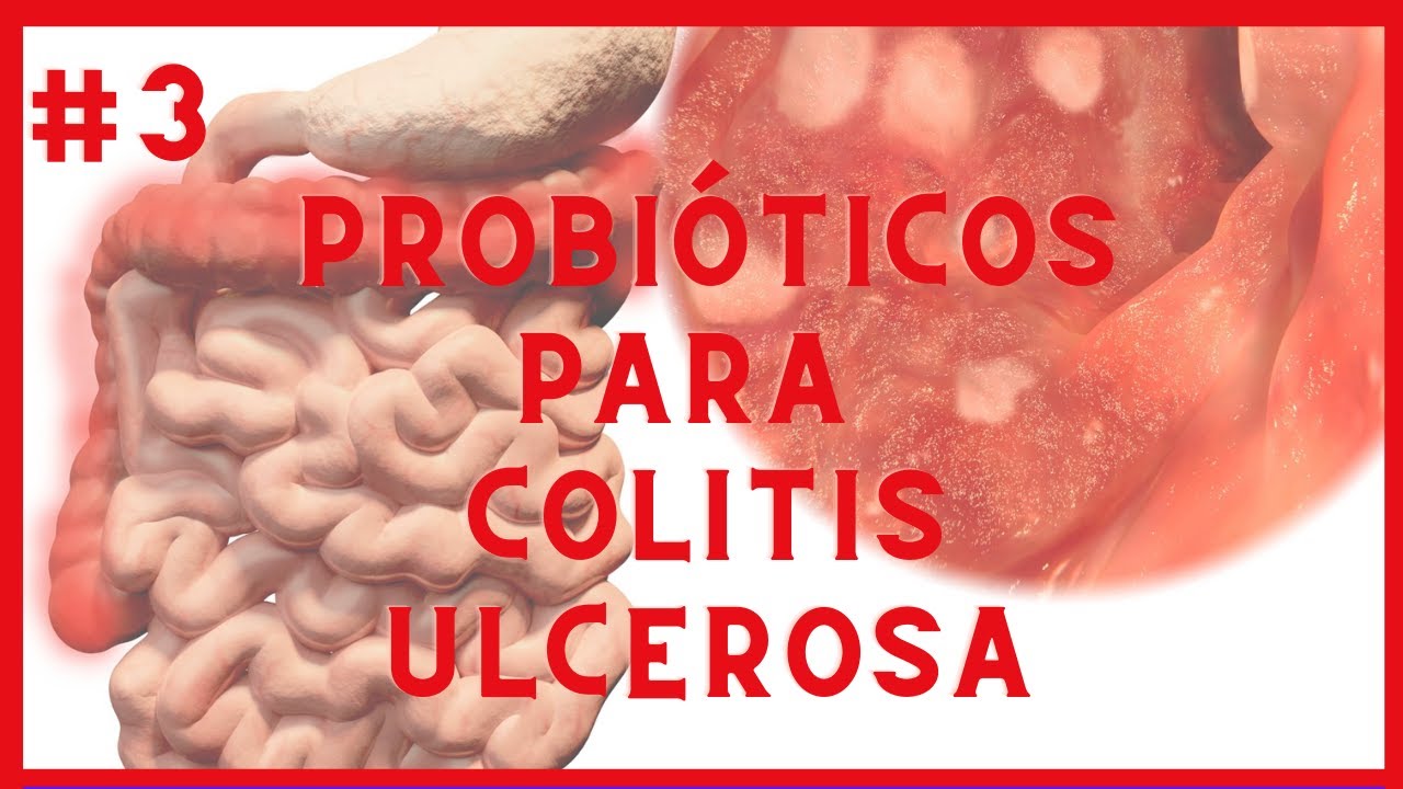 cuál es el mejor probiótico para la colitis ulcerosa
