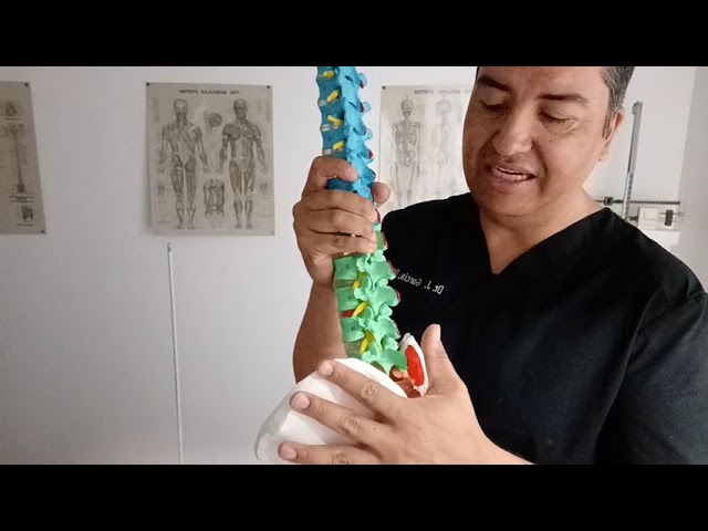 cuánto dura el dolor de ciática