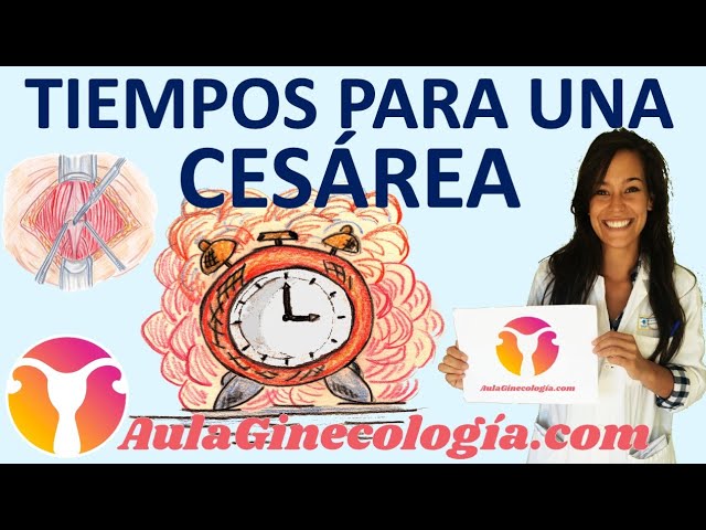 cuanto dura una cesárea de urgencia