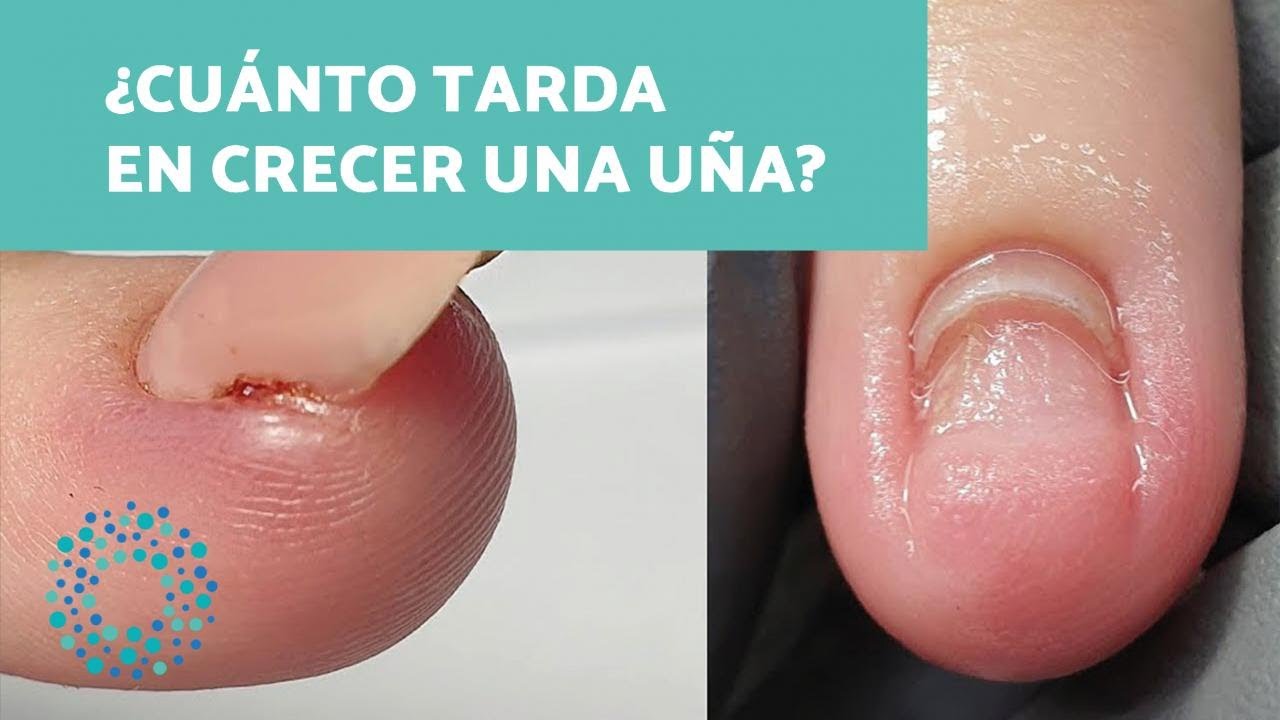 cuanto tarda en crecer una uña del pie
