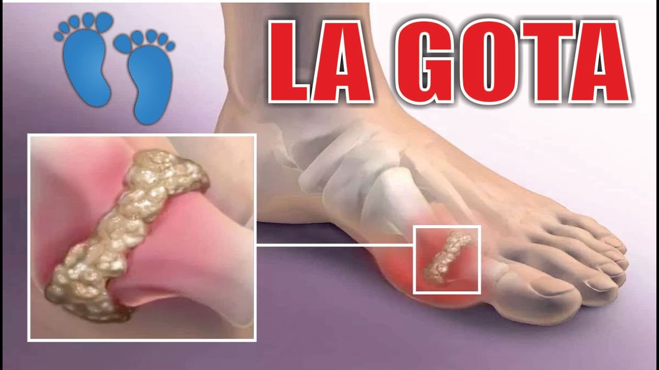 dolor dedo gordo del pie derecho