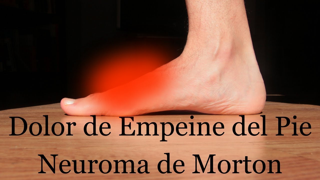 dolor en el empeine del pie sin inflamacion