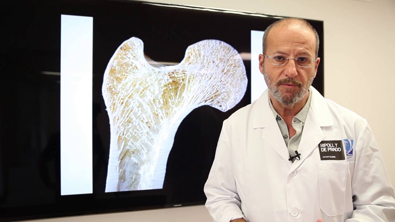 edema óseo tobillo tiempo de recuperación