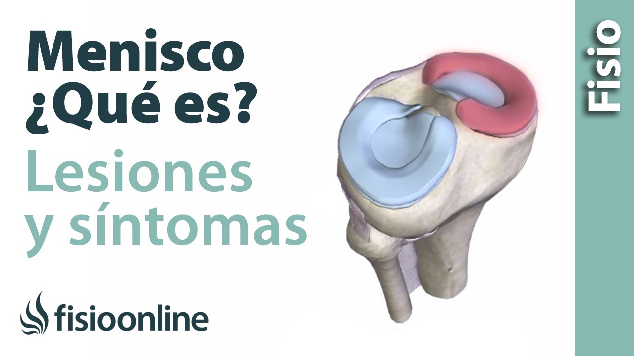 el menisco se ve en una radiografia