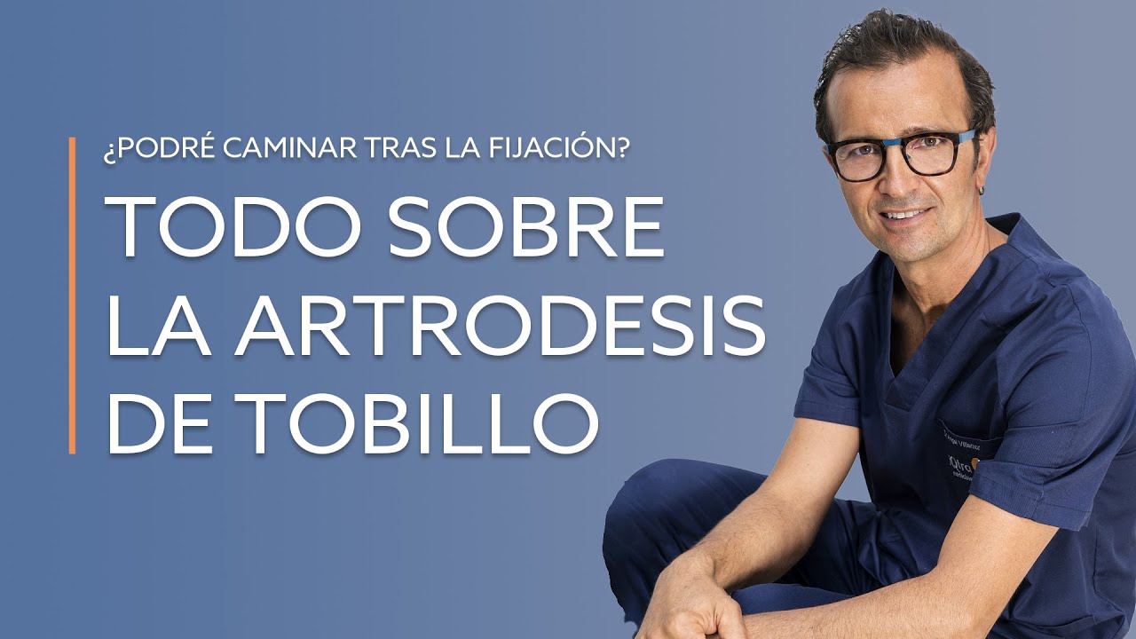 grado de minusvalía por artrodesis de tobillo