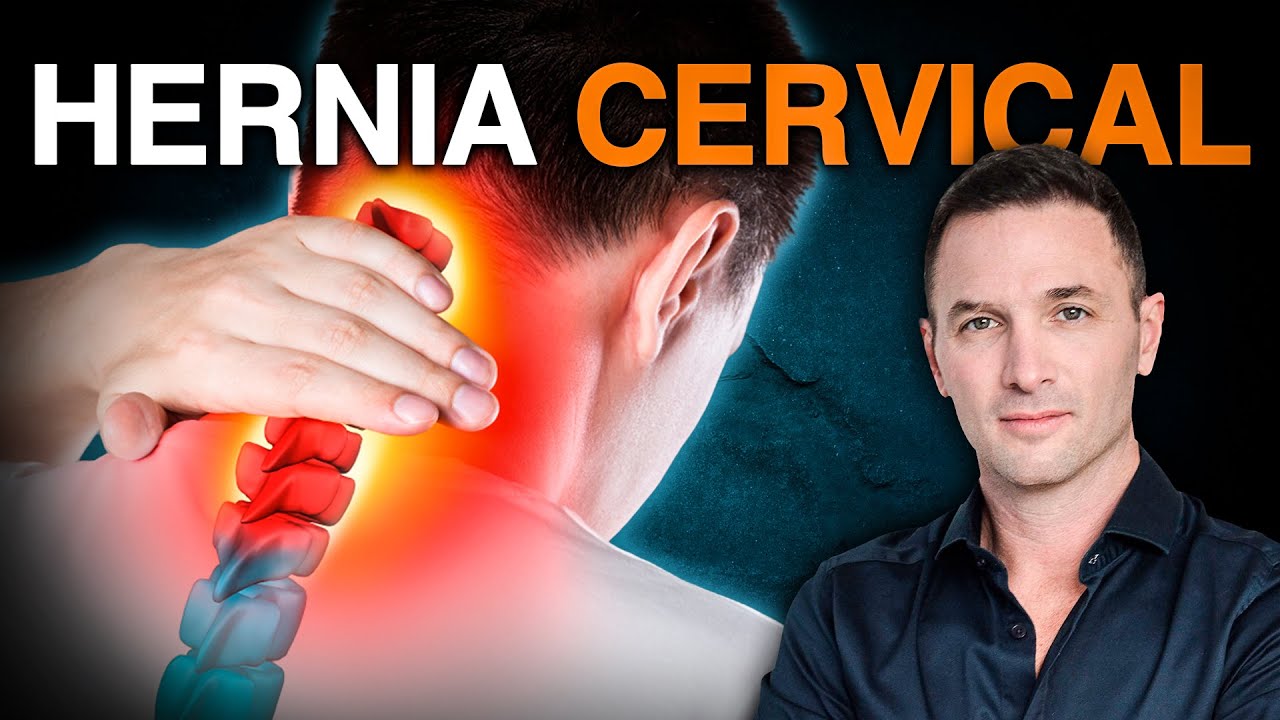 hernia cervical síntomas dolor de cabeza