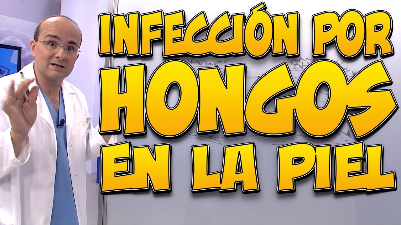hongo en la piel por humedad