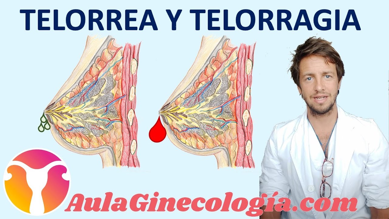 hongos en el pezón sin lactancia