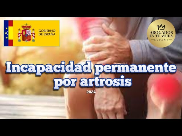 incapacidad por artrosis en las manos