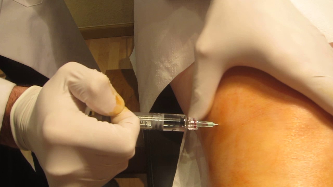 infiltraciones de acido hialuronico en rodilla