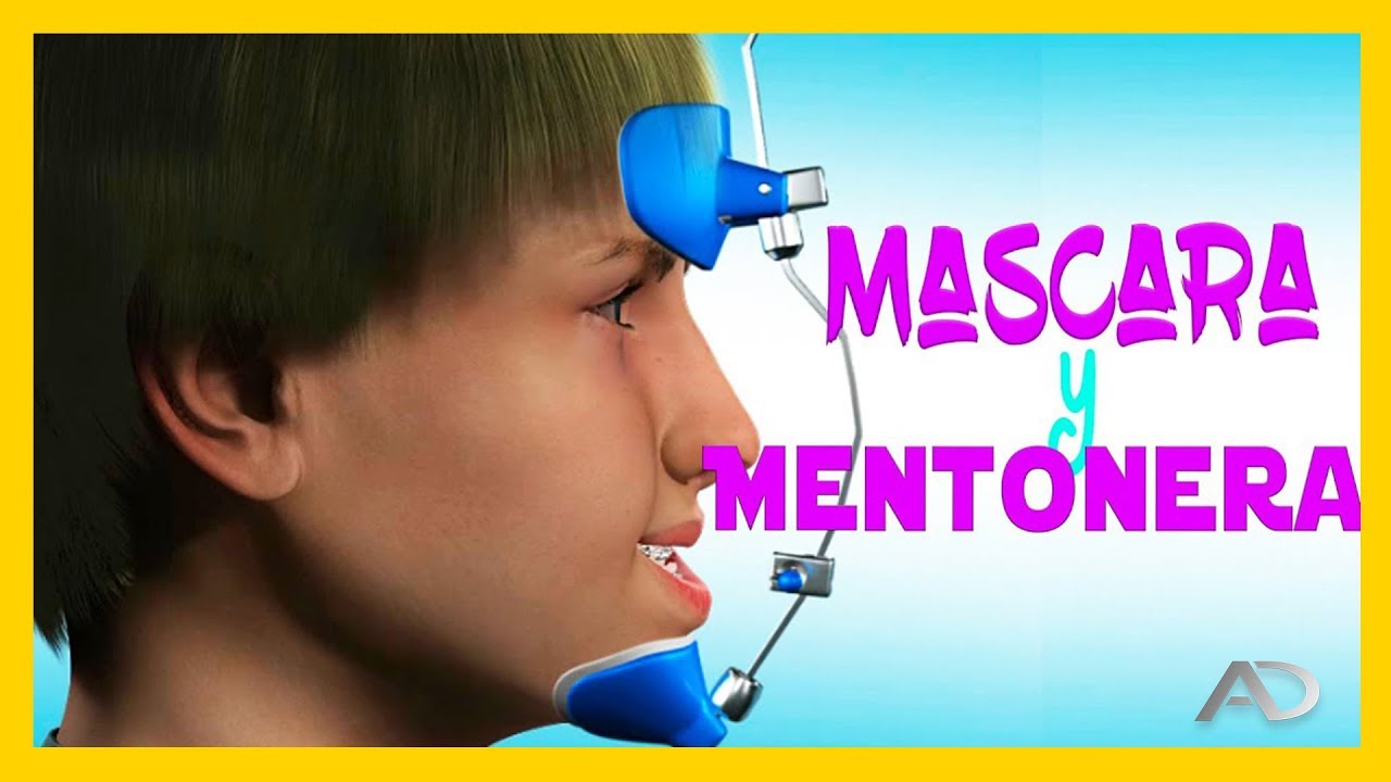 máscara facial ortodoncia antes y después